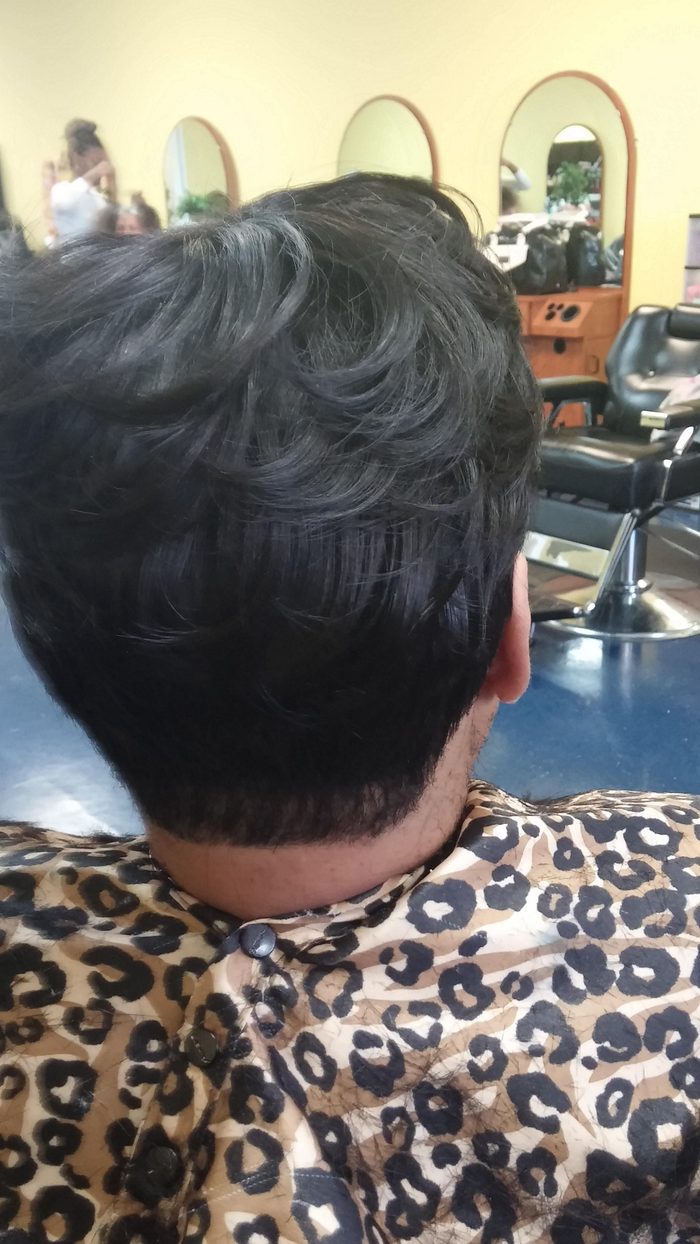 Client 2 after hair restoration